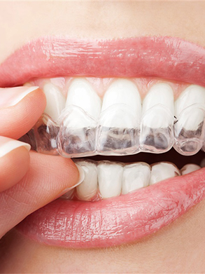 invisalign costs