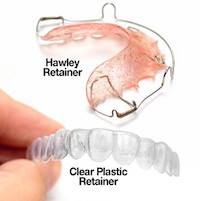 retainers