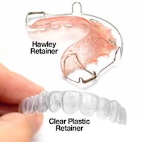 retainers